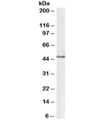 GATA Binding Protein 1 Antibody Human PBMC WB. Western blot analysis of GATA1 expression was performed using anti-GATA1 antibody on human peripheral blood mononuclear cell (PBMC) lysate. A specific immunoreactive band is detected at approximately 43 kDa, consistent with the predicted molecular weight of GATA1. GATA1 is a zinc finger transcription factor that serves as a master regulator of erythropoiesis by controlling genes required for erythroid lineage commitment, hemoglobin synthesis, and red blood cell maturation. Although GATA1 expression is primarily associated with erythroid and megakaryocytic lineages, its detection in PBMC lysate reflects the presence of hematopoietic cell populations expressing this lineage-specific transcription factor. These results support the utility of GATA Binding Protein 1 Antibody for studies of hematopoiesis, erythropoiesis, hematopoietic transcriptional regulation, and blood cell differentiation.