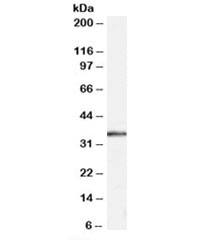 Western blot testing of human muscle lysate with STUB1 antibody at 0.3ug/ml. Predicted molecular weight: ~35kDa.