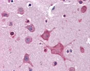 IHC testing of FFPE human cortex (brain) tissue with DPP10 antibody at 3.75ug/ml. Required HIER: steamed antigen retrieval with pH6 citrate buffer; AP-staining.