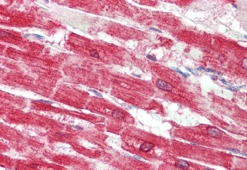 IHC staining of FFPE human heart tissue with SERCA2 antibody at 5ug/ml. Required HIER: steamed antigen retrieval with pH6 citrate buffer; AP-staining.