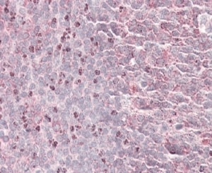 IHC staining of FFPE human tonsil with SEPT6 antibody at 4ug/ml. HIER: steamed with pH6 citrate buffer, AP-staining. The dividing cells outside the germinal center are specifically stained.