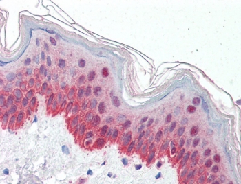 IHC testing of FFPE human skin with P4HA1 antibody at 5ug/ml. Required HIER: steamed antigen retrieval with pH6 citrate buffer; AP-staining.