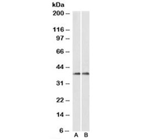 Western blot testing of fetal mouse brain (A) and adult rat brain (B) lysates with ARPC1A antibody at 0.1ug/ml. Predicted molecular weight: ~42/39 kDa (isoform 1/2).