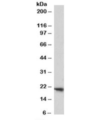 FTH1 Antibody Placenta WB. Western blot testing of human placenta lysate with FTH1 antibody at 1ug/ml. Predicted molecular weight: ~21 kDa.