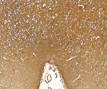 FTH1 Antibody Cerebral Cortex IHC. Immunohistochemistry staining of FFPE human cerebral cortex tissue with FTH1 antibody at 5ug/ml. Required HIER: steamed antigen retrieval with pH6 citrate buffer; HRP-staining.