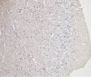 Negative control: IHC staining of FFPE human cerebral cortex tissue without primary antibody. HIER: steamed with pH6 citrate buffer, HRP-staining.