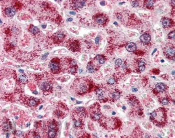 Catalase Antibody / Hydrogen Peroxide Detoxification Enzyme Human Liver IHC. Immunohistochemical staining of FFPE human liver tissue using Catalase Antibody / Hydrogen Peroxide Detoxification Enzyme at 2 ug/ml. Catalase expression is detected predominantly within the cytoplasm of hepatocytes, consistent with its localization in peroxisomes and its essential role in hydrogen peroxide detoxification and maintenance of cellular redox homeostasis. Heat-induced epitope retrieval was performed by steaming sections in pH 6 citrate buffer prior to AP-based immunostaining.