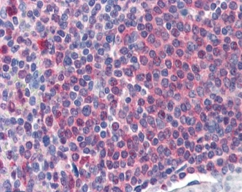 Catalase Antibody / Hydrogen Peroxide Detoxification Enzyme Human Spleen IHC. Immunohistochemical staining of FFPE human spleen tissue using Catalase Antibody / Hydrogen Peroxide Detoxification Enzyme at 2 ug/ml. Catalase expression is detected predominantly within the cytoplasm of splenic lymphoid cells, consistent with its role in protecting immune cells from oxidative stress through the detoxification of hydrogen peroxide. Heat-induced epitope retrieval was performed by steaming sections in pH 6 citrate buffer prior to AP-based immunostaining.
