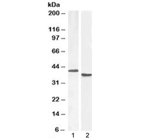Western blot testing of 1) mouse spleen lysate at 1ug/ml and 2) rat spleen lysate at 0.3ug/ml with PAX5 antibody. Predicted molecular weight ~42 kDa.