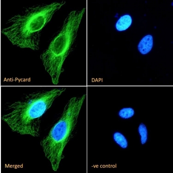 ASC Antibody / PYCARD HeLa Cell IF. Immunofluorescent staining of fixed and permeabilized human HeLa cells using ASC Antibody / PYCARD (green) at 10 ug/ml with DAPI nuclear counterstain (blue). PYCARD is detected predominantly within the cytoplasm, consistent with its role as an inflammasome adaptor protein that mediates ASC speck formation, inflammatory caspase activation, and innate immune signaling. The merged image demonstrates the cytoplasmic localization of PYCARD, while the negative control confirms staining specificity.