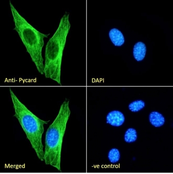 ASC Antibody / PYCARD NIH3T3 Cell IF. Immunofluorescent staining of fixed and permeabilized mouse NIH3T3 cells using ASC Antibody / PYCARD (green) at 10 ug/ml with DAPI nuclear counterstain (blue). PYCARD is detected predominantly within the cytoplasm, consistent with its function as an inflammasome adaptor protein involved in ASC speck formation, inflammatory signaling, and innate immune responses. The merged image demonstrates cytoplasmic localization of PYCARD, while the negative control confirms staining specificity.