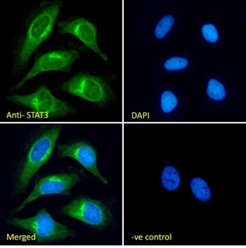 Immunofluorescent staining of fixed and permeabilized human HeLa cells with STAT3 antibody (green) at 10ug/ml and DAPI nuclear stain (blue).