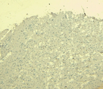 Negative control: IHC staining of FFPE human liver tissue without primary antibody. HIER: steamed with pH6 citrate buffer, HRP-staining.