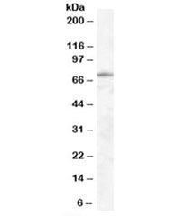 Western blot testing of human lung lysate with EXOC7 antibody at 0.5ug/ml. Predicted molecular weight: ~75kDa.