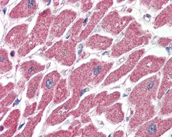 IHC staining of FFPE human heart with CPT1A antibody at 4ug/ml. HIER: steamed with pH6 citrate buffer, AP-staining.