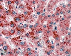 IHC staining of FFPE human liver with AKR1C4 antibody at 2.5ug/ml. HIER: steamed with pH6 citrate buffer, AP-staining.