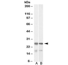 Western blot of mouse (A) and rat (B) brain lysate with TPPP antibody at 0.001ug/ml. Predicted molecular weight: ~24 kDa.