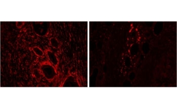 IHC staining of FFPE human pancreas with HMOX2 antibody at 2ug/ml: cancer tissue (left), adjacent to cancer tissue (right). HIER: steamed with pH6 citrate buffer, Alexa Fluor 594-staining.