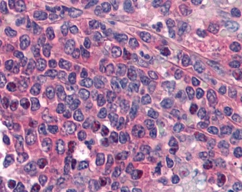IHC testing of FFPE human spleen tissue with PTGER1 antibody at 5ug/ml. Required HIER: steamed antigen retrieval with pH6 citrate buffer; AP-staining.