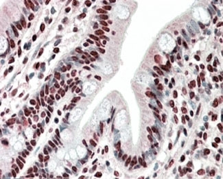 IHC staining of FFPE human small intestine with HNRNPA2B1 antibody at 5ug/ml. HIER: steamed with pH6 citrate buffer, AP-staining.