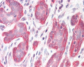 IHC testing of FFPE human breast tissue with PDLIM4 antibody. Required HIER: steamed antigen retrieval with pH6 citrate buffer; AP-staining.