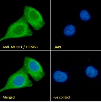 IF/ICC staining of fixed and permeabilized human A549 cells with MURF1 antibody (green) at 10ug/ml and DAPI nuclear stain (blue).