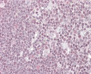IHC staining of FFPE human thymus with NIPP1 antibody at 4ug/ml. HIER: steamed with pH6 citrate buffer, AP-staining. Speckled staining of the nuclei is seen.