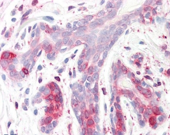 IHC testing of FFPE human breast tissue with ERLIN2 antibody at 3.75ug/ml. Required HIER: steamed antigen retrieval with pH6 citrate buffer; AP-staining.