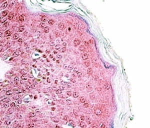 TRIM29 Antibody Skin IHC. Immunohistochemistry of TRIM29 antibody in FFPE human skin. Formalin-fixed, paraffin-embedded human skin tissue was stained using a goat polyclonal TRIM29 antibody at 4 ug/ml. AP-red chromogenic signal demonstrates cytoplasmic and nuclear staining in epidermal keratinocytes, with signal most prominent in the suprabasal epithelial layers. Heat-induced epitope retrieval was performed by steaming tissue sections in pH 6 citrate buffer prior to antibody incubation.