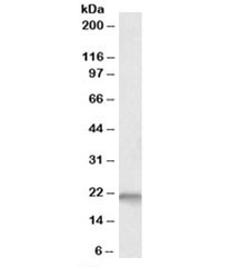 NSG1 Antibody Fetal Mouse Brain WB. Western blot analysis was performed on fetal mouse brain lysate using NSG1 Antibody at 0.1 ug/ml. A specific immunoreactive band is detected at approximately 21 kDa, consistent with the predicted molecular weight of Neuron Specific Gene Family Member 1 (NSG1). The blot demonstrates reliable detection of endogenous NSG1 in developing neural tissue, supporting its known expression during neuronal development and endosomal trafficking. These results demonstrate that this Neuron Specific Gene Family Member 1 Antibody is suitable for Western blot detection of endogenous NSG1 in fetal mouse brain lysates.