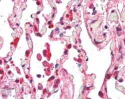 IHC staining of FFPE human lung with ACAP1 antibody at 5ug/ml. HIER: steamed with pH6 citrate buffer, AP-staining.