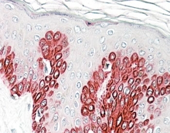 Sirtuin 1 Antibody Skin IHC. Immunohistochemistry staining of FFPE human skin with Sirtuin 1 antibody at 4ug/ml. HIER: steamed with pH6 citrate buffer, AP-staining.