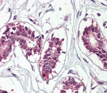 IHC staining of FFPE human breast tissue with ZBP-1 antibody. Required HIER: steamed antigen retrieval with pH6 citrate buffer; AP-staining.