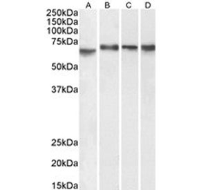 Western blot testing of A) human Caco-2, B) human K562, C) human HepG2 and D) mouse NIH-3T3 cell lysate with ZBP-1 antibody. Predicted molecular weight: ~64 kDa.