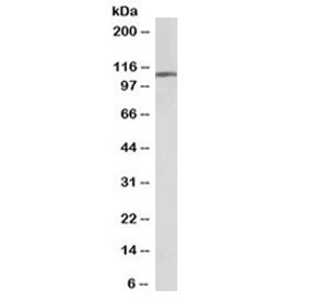 AP2A1 Antibody Biotin Conjugate Human Brain WB. Western blot testing of human frontal cortex lysate with AP2A1 Antibody Biotin Conjugate at 0.01 ug/ml. A specific band was detected at approximately 108 kDa, consistent with the predicted molecular weight of AP2A1. This biotinylated AP2A1 antibody format supports detection using avidin-biotin or streptavidin-based systems. AP2A1 Antibody Biotin Conjugate supports studies of alpha adaptin expression, AP-2 adaptor complex function, clathrin-mediated endocytosis and neuronal membrane trafficking pathways.