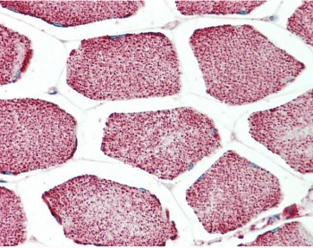 IHC testing of FFPE human skeletal muscle tissue with Apolipoprotein L4 antibody at 5ug/ml. Required HIER: steamed antigen retrieval with pH6 citrate buffer; AP-staining.