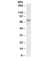 TP63 Antibody A431 Cell WB. Western blot analysis of A431 cell lysate using a TP63 antibody as a cell proliferation regulatory protein marker demonstrates detection of Tumor protein 63 (TP63) as a band near ~70 kDa, consistent with the expected molecular weight range of 63-77 kDa for TP63 isoforms. The band is well-defined with minimal background, supporting specific recognition of TP63 in denatured lysates. The observed signal aligns with known expression of TP63 in proliferative epithelial-derived cell lines such as A431, where TP63 contributes to maintenance of growth and undifferentiated cellular states. The clean banding pattern supports use of this TP63 antibody for western blot analysis of proliferation-associated TP63 expression.