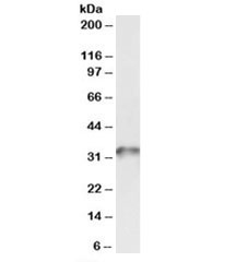 Western blot testing of human platelet lysate with TPM4 antibody at 0.03ug/ml. Predicted molecular weight: ~33kDa.