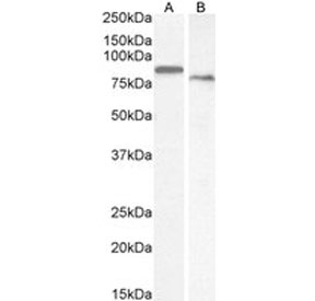 Western blot testing of A) human placenta and B) mouse kidney tissue lysate with Transglutaminase 2 antibody. Predicted molecular weight: ~78 kDa.