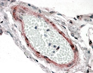 IHC staining of FFPE human lung with CSRP2 antibody at 3.8ug/ml. HIER: steamed with pH6 citrate buffer, AP-staining.