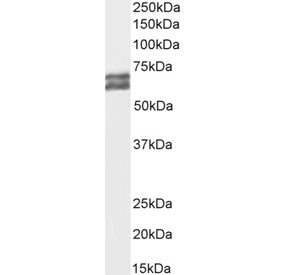 Western blot testing of human MCF7 cell lysate with AMHR2 antibody at 1ug/ml. Predicted molecular weight: ~63/52/52 kDa (isoforms 1/2/3).