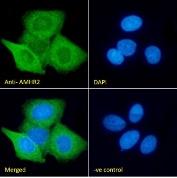 IF/ICC staining of fixed and permeabilized human MCF7 cells with AMHR2 antibody (green) at 10ug/ml and DAPI nuclear stain (blue).