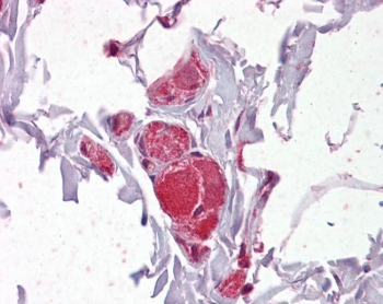 IHC testing of FFPE human colon tissue with VAV2 antibody at 2.5ug/ml. Required HIER: steamed antigen retrieval with pH6 citrate buffer; AP-staining.