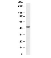 Cytokeratin 20 Antibody Biotin Conjugate for WB. Western blot analysis of human colon lysate using biotinylated Cytokeratin 20 antibody at 1 ug/ml. Lane 1: human colon tissue lysate. A band is detected at approximately 49 kDa, consistent with the predicted molecular weight of Keratin 20 / Cytokeratin 20 (KRT20), an epithelial intermediate filament protein strongly expressed in gastrointestinal epithelial cells.