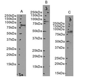 Western blot testing of human 1) U937, B) K562 and C) MOLT-4 cell lysates with LFA-1 antibody  Predicted/observed molecular weight: 85~95 kDa depending on glycosylation level.