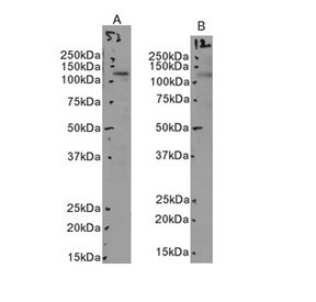Western blot testing of human A) ThP1 and B) A549 cell lysate with MERTK antibody at 3.5ug/ml. Predicted molecular weight: 110~205 kDa depending on glycosylation level.