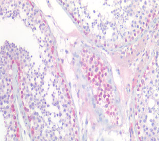 IHC staining of FFPE human testis tissue with UCHL1 antibody at 5ug/ml. Required HIER: steamed antigen retrieval with pH6 citrate buffer; AP-staining.