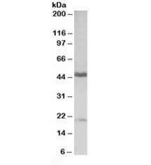 GATA3 Antibody Tonsil WB. Western blot testing of human tonsil lysate with GATA3 antibody at 0.3ug/ml. Predicted molecular weight ~50 kDa. Both bands are blocked by the immunizing peptide.