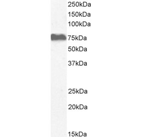 NOX5 Antibody Adrenal Gland WB. Western blot testing of human adrenal gland tissue lysate with NOX5 antibody. Predicted molecular weight: ~86 kDa.