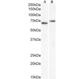 Western blot testing of human A) HeLa and B) Caco-2 cell lysate with NOX5 antibody. Predicted molecular weight: ~86 kDa.